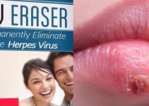 Herpes Erased Review